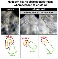 Haddock Heart Deformities Following Exposure to Crude Oil