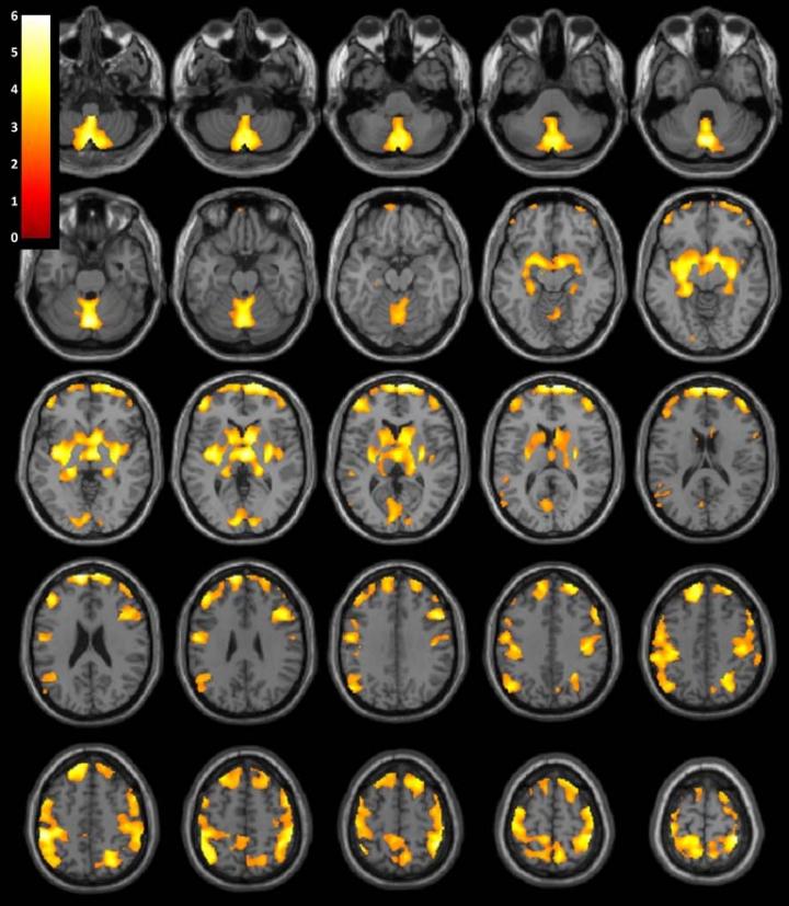 Brain Imaging (2 of 2)