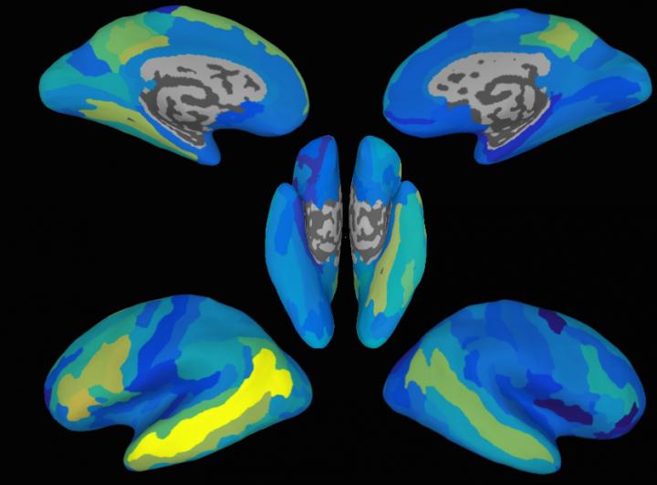 Predictions of Brain Activity Patters for Sentences