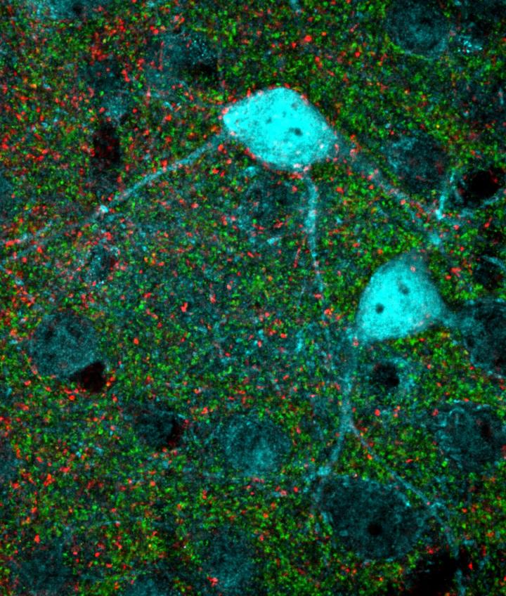 Restoring Brain Plasticity