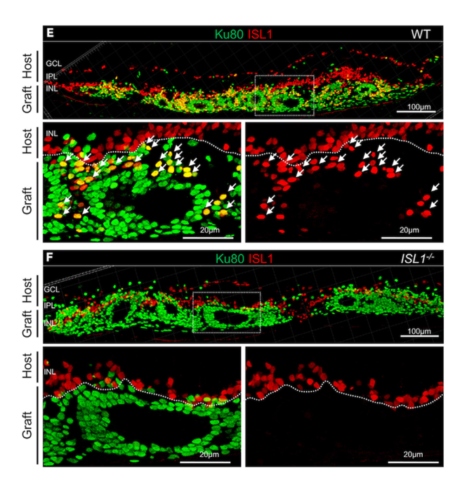 Bipolar cells die off in the new type of retinal sheets