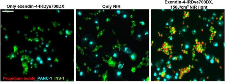 Fluorescence Microscopy of INS-1 cells and PANC 1 cells.