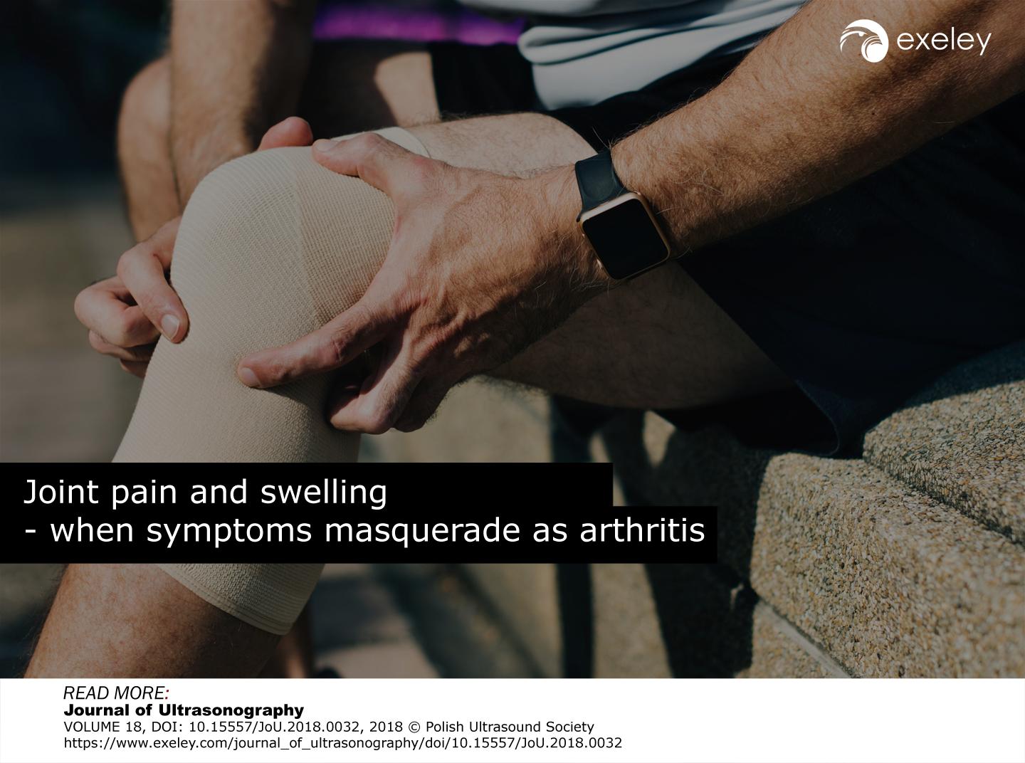 Arthritis Mimicry