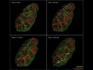 Under the Microscope, Shape-Shifting Cells (3 of 5)