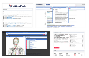 Upgraded clinical decision support system PubCaseFinder