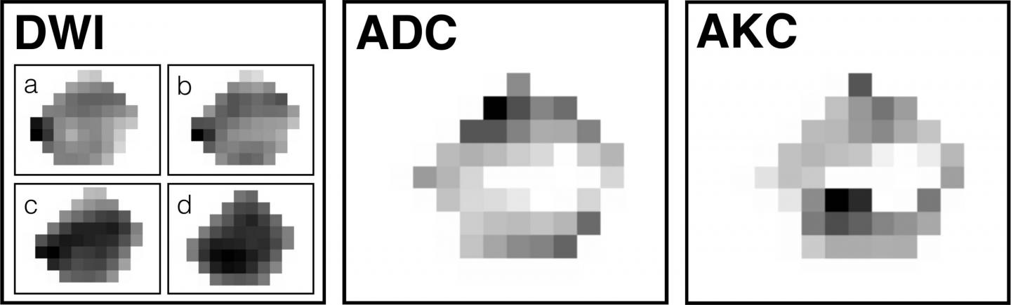 Two-dimensional Sections of a Three-dimensional Acquisition of Images of a Malignant Tumor