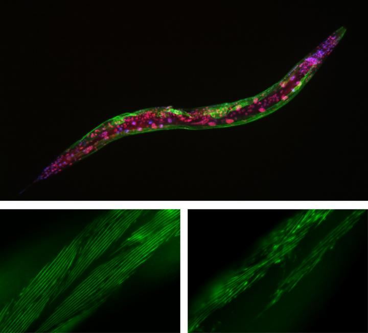Irregular Muscle Fibers