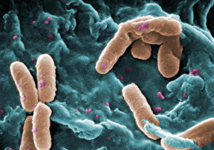 Pseudomonas aeruginosa bacteria