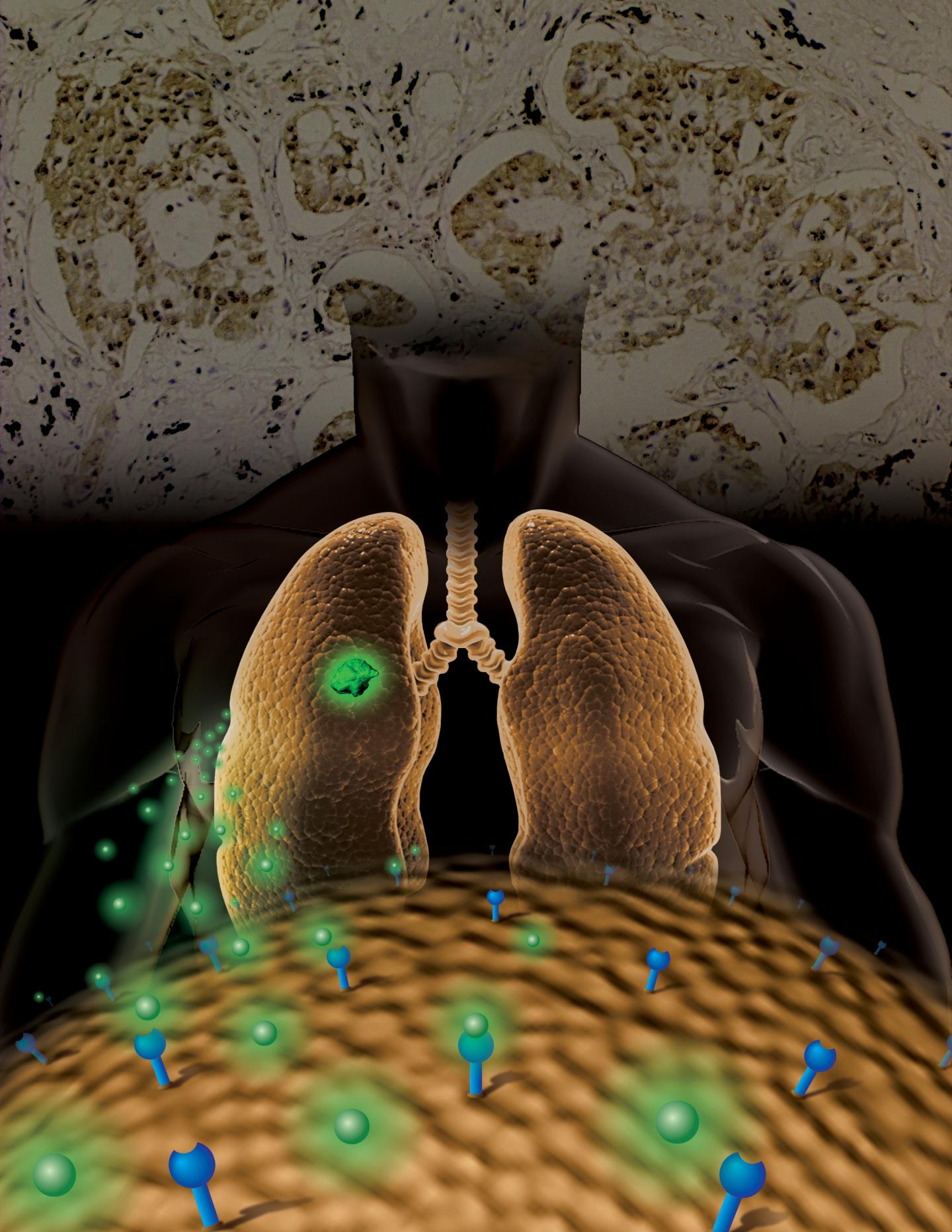 Novel Molecular Imaging Strategy for Determining Molecular Classifications of NSCLC