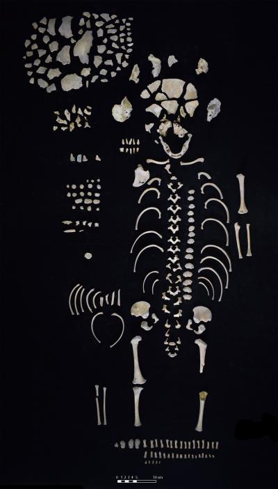 Juvenile Skeleton
