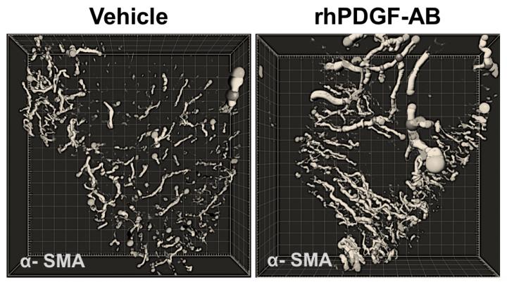 Repair Treatment for Heart Attacks Advances Through Pig Trial (2 of 6)