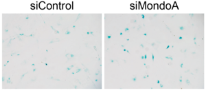 Fig. 1 MondoA depletion promotes senescence