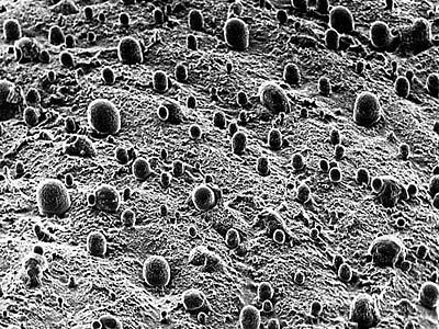 A Scanning Electron Micrograph of Sweat on a Human Index Finger Tip