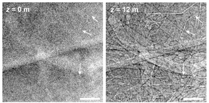 Conventional v. Phase Contrast X-ray