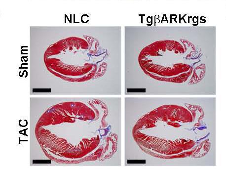 Peptide Peps Up a Failing Heart