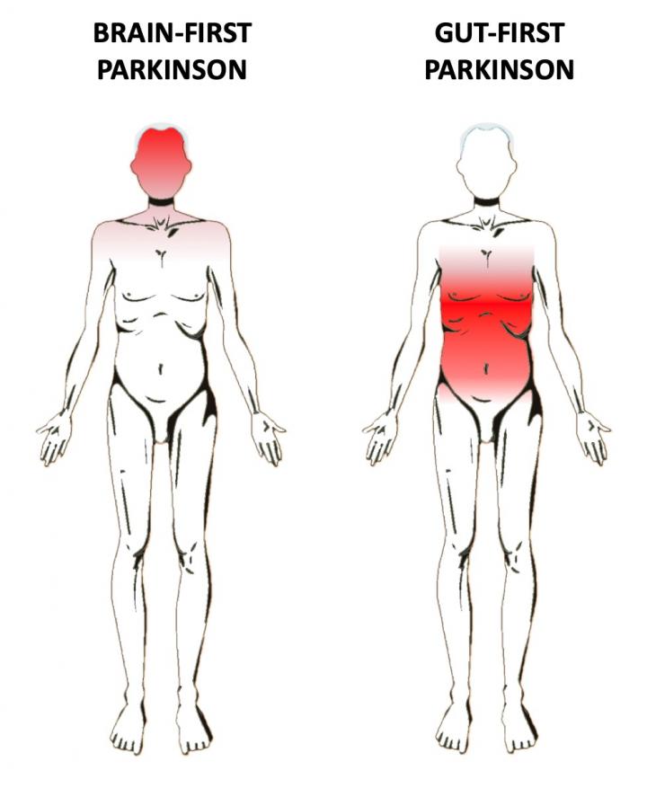 Brain-First, and Gut-First