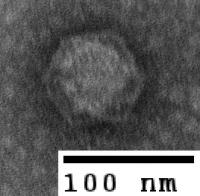 A Tailless Bacteriophage