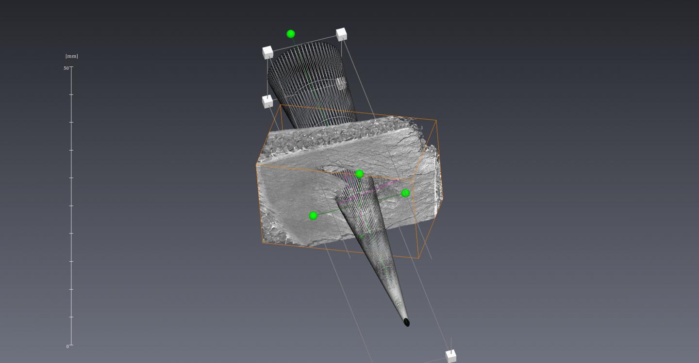 Micro-CT Scan of the Lesion