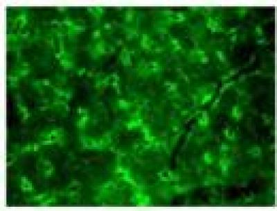 Endorphin Positive Cells