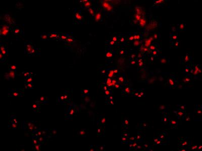 Cluster of Mast Cells Found Underneath Superficial Bladder Epithelium