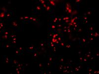 Cluster of Mast Cells Found Underneath Superficial Bladder Epithelium