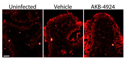 UPEC-infected Mouse Bladders