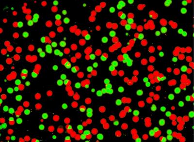HIV Drug Resistance Test