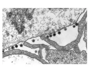 Epstein-Barr virus (EBV)