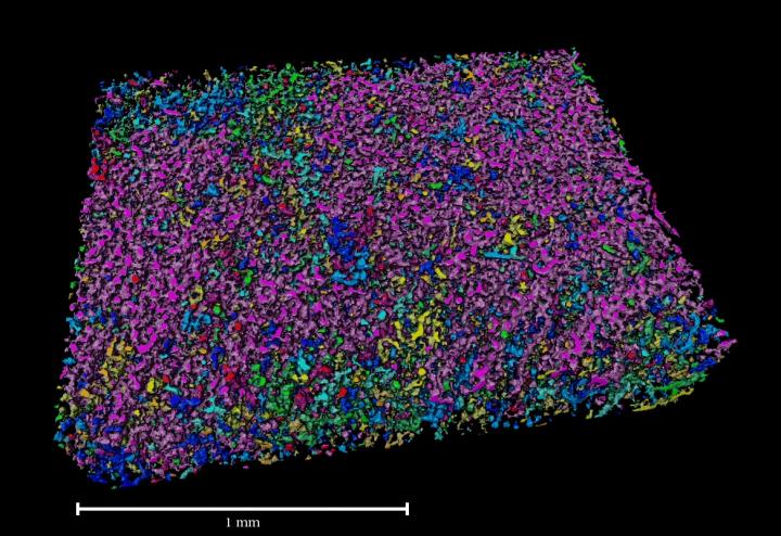 Microcomputer tomography image of the hydrogel