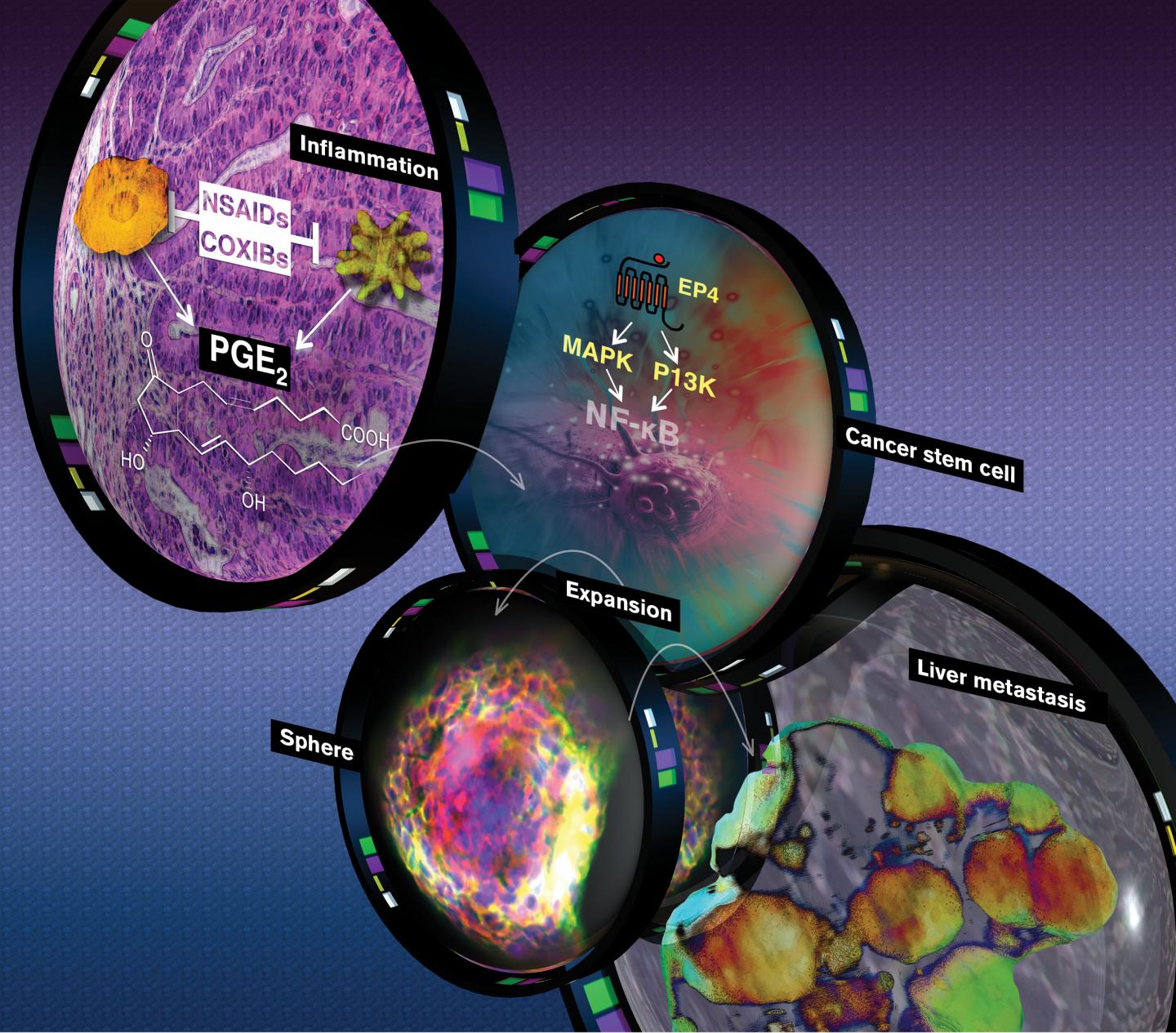 A New Lens on Colorectal Cancer