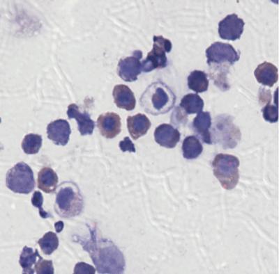 &#946;-thalassemia-corrected Blood Cells