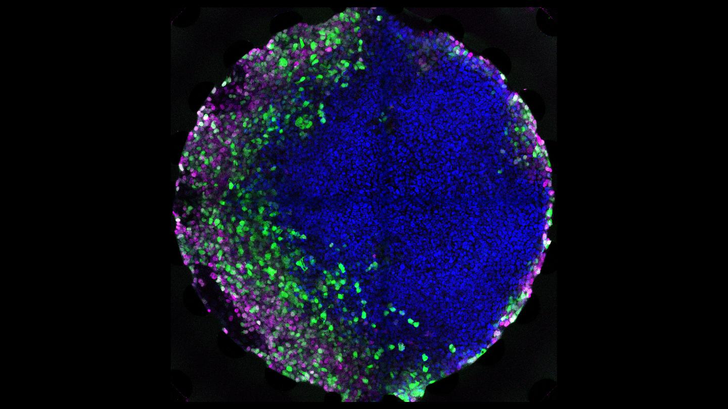 Colony of Human Embryonic Stem Cells