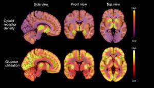 Anorexia and number of opioid receptors