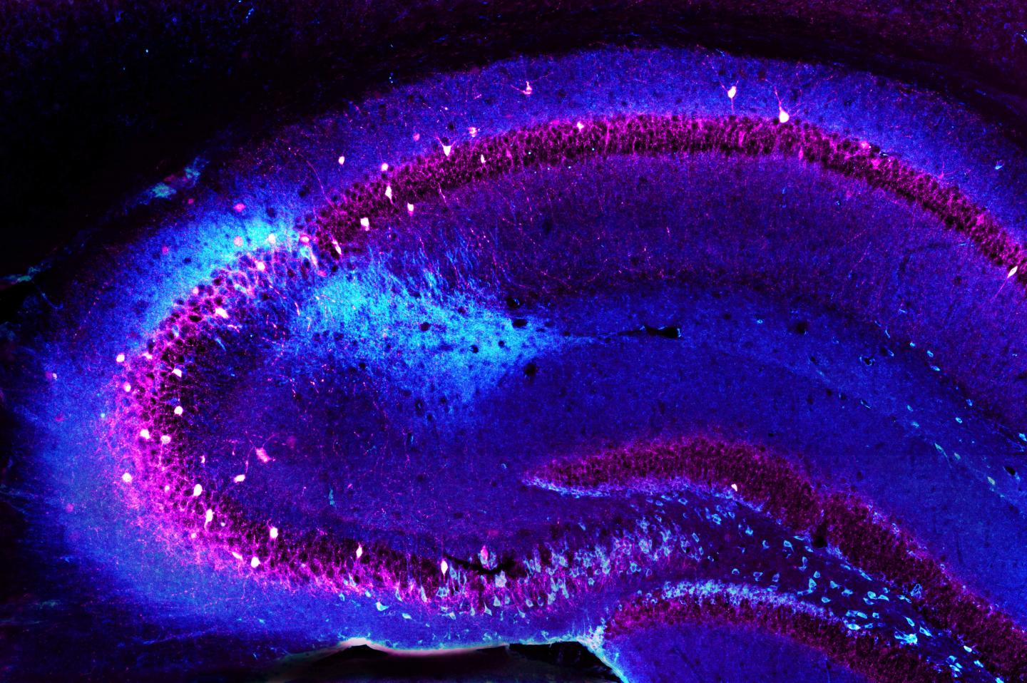 Hippocampus Showing CA2 Inhibitory Neurons