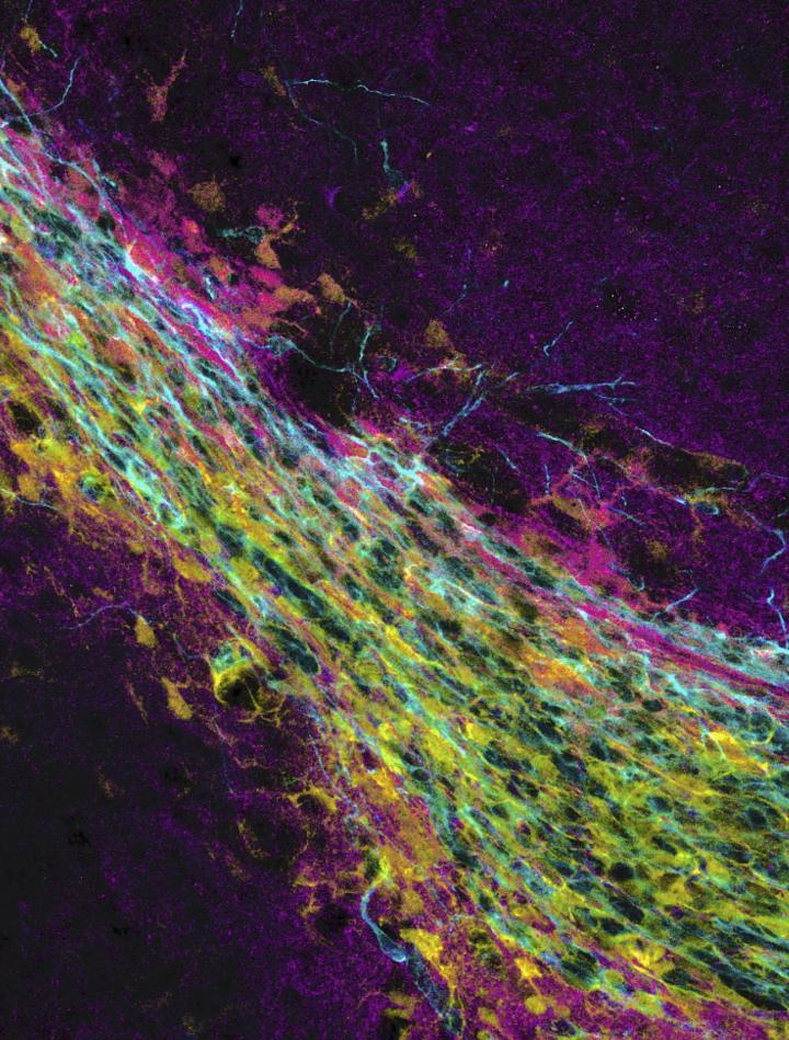 Neuronal Progenitor Cells Travel from the Subependymal Zone to the Olfactory Bulb