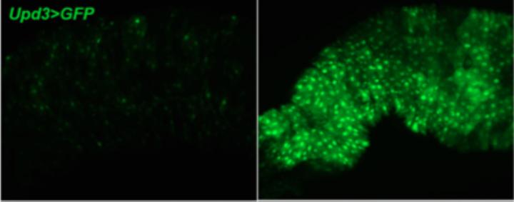 Genetic Switch Turned on During Fasting Helps Stop Inflammation