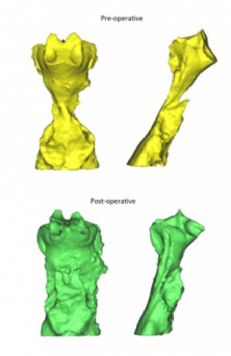 Airway images