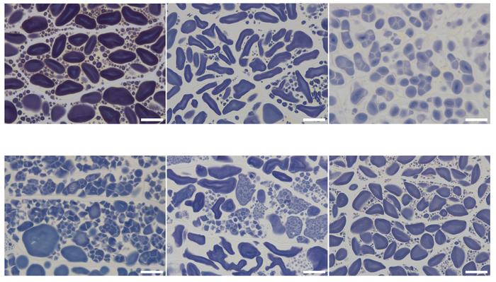 Variations in starch granule morphology caused by mutations in genes from the starch biosynthetic pathway in barley