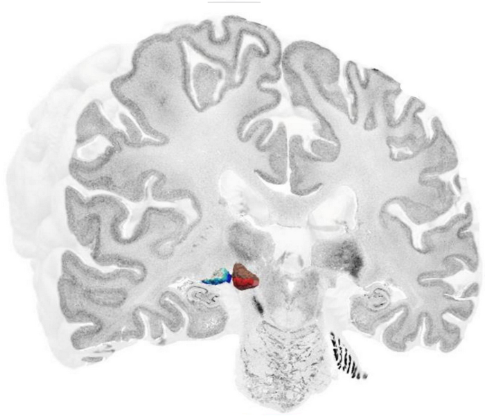 Metathalamus