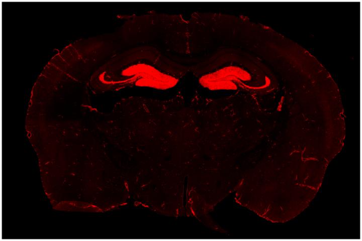 Neuroinflammation and Psychological Disorders