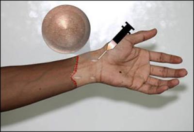 Hydrogel-Transplant Drug Combo