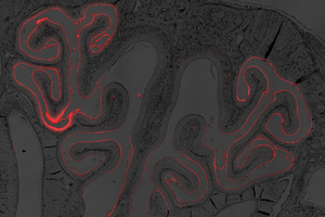 Histology image of vaccine in nasal cavity