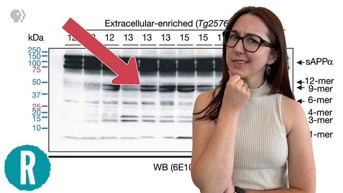 How a retracted paper affected the course of Alzheimer’s research (video)