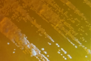 Colonies of Candida tropicalis.