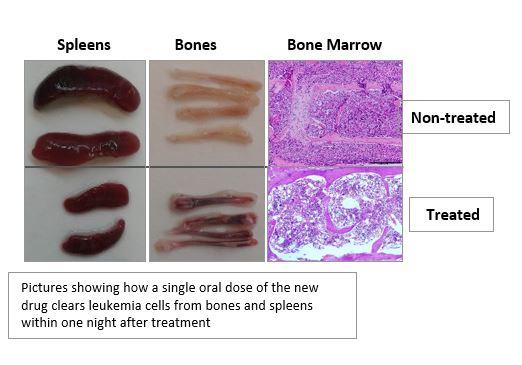 Leukemia Cancer Cells Before and After New Drug Treatment