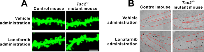 Figure 1: Neuronal alteration in Tsc2+/- mice and the effect of lonafarnib administration.