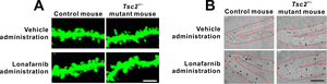 Figure 1: Neuronal alteration in Tsc2+/- mice and the effect of lonafarnib administration.