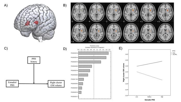 New Study Finds Neurobiological Evidence of Peripartum Depression in Women, Distinguishing It from Major Depressive Disorder