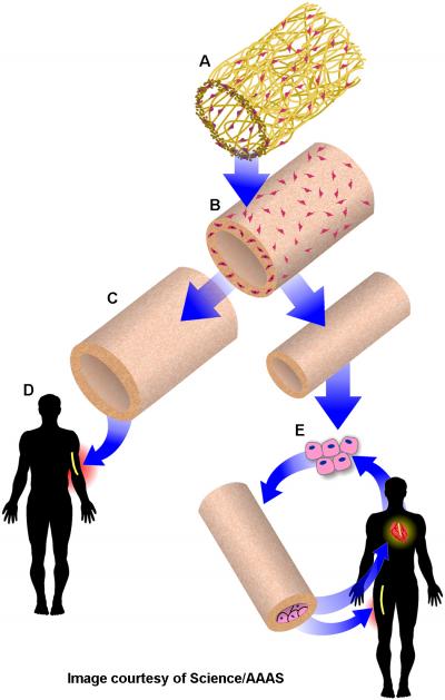 Generation of Bioengineered Vein