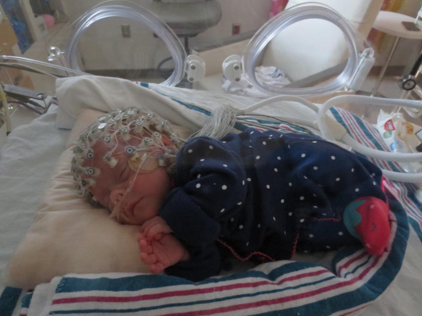 Measuring Preterm Baby Brain Function